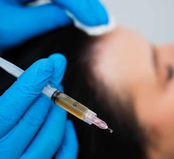 PRP + Mesotherapy (Serums) for Hairfall