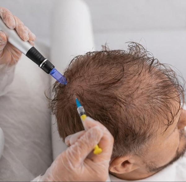 Exosomes for Hair