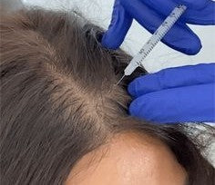 PRP — Hair with Meso Serums