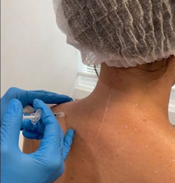 Barbie Neck Botox (Traptox)