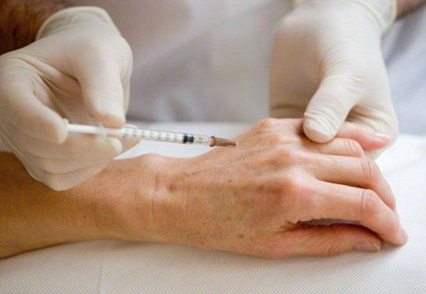 PRP — Hands Rejuvenation