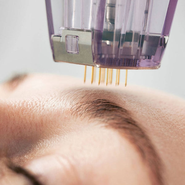 RF Microneedling