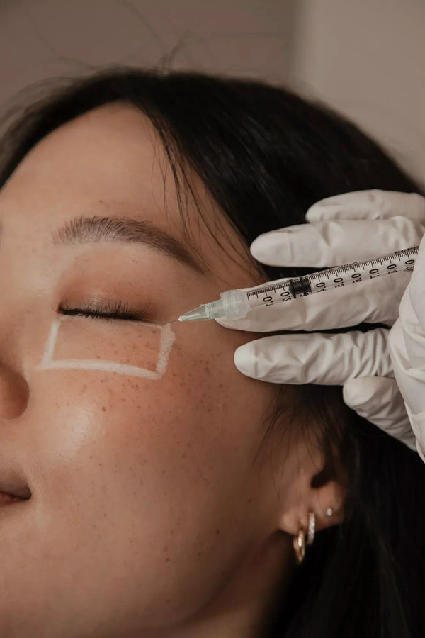 PRF for Under Eye