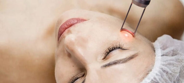 Pico Laser — Under Eye