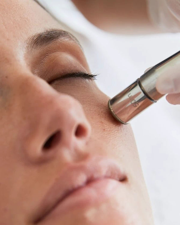Diamond  Dermabrasion Facial