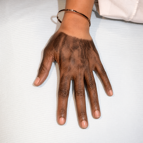 Carbon Peel — Hand / Feet