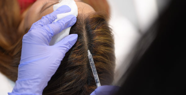 PRP — Hair Fall