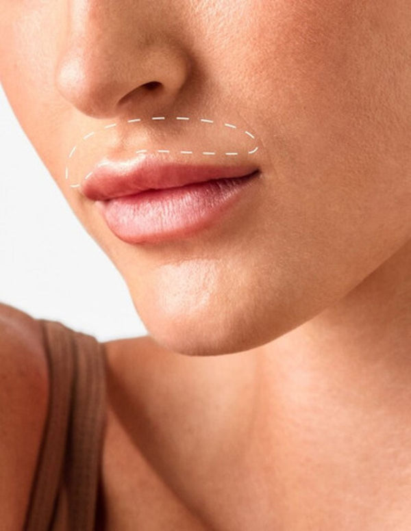 Upper Lip