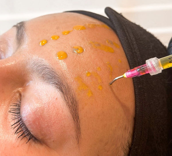 Biorey Peel