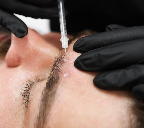 Botox — Frown / Forehead / Crow's Feet