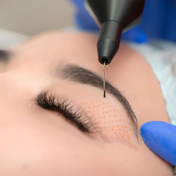 Fibroblast Therapy